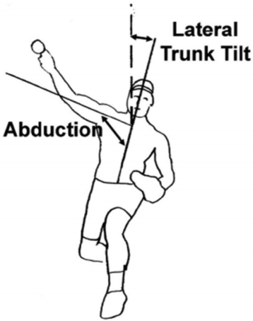 Lateral abduction of the arm essay image