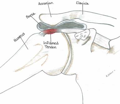 prominent_acromion