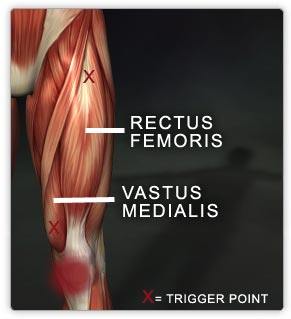 Quadriceps Muscle Group