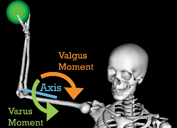 Valgus moment