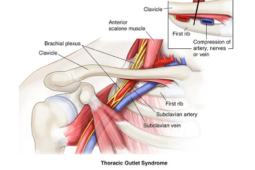 The Potential Impacts Of Tos On A Career And Possible Treatments